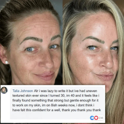 NMN Complex - 1000mg capsules